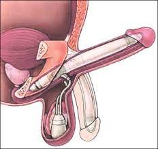 Penile lengthening